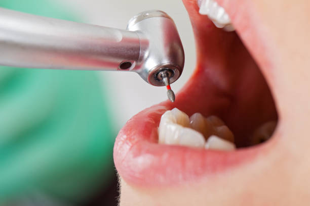  Simmesport, LA Emergency Dentist Pros